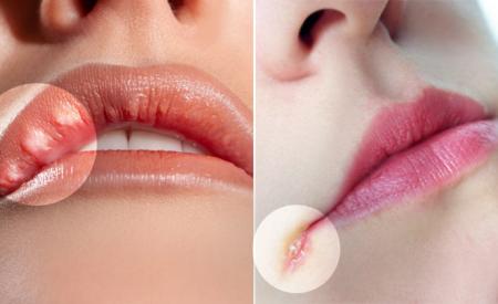 10 điều về đôi môi tiết lộ tình trạng sức khỏe của bạn