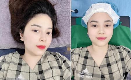 'Bà mẹ 6 con' Hằng Túi 'can thiệp thẩm mỹ', hội mẹ bỉm sữa rần rần khi thấy chỉ làm 30 phút mà kết quả xinh lên thấy rõ 